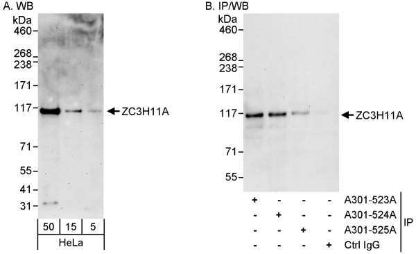 Anti-ZC3H11A