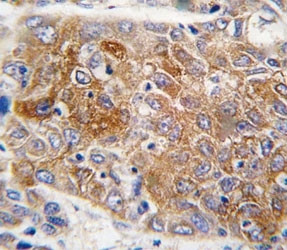 Anti-ALDH1L1