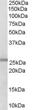 Anti-GSTM1 / GSTM2, C-terminal