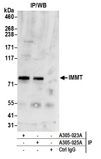 Anti-IMMT/Mitofilin