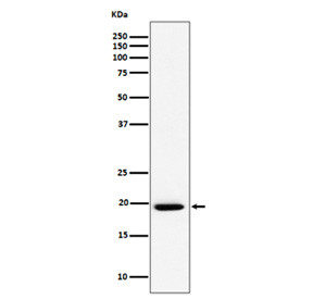 Anti-UFC1 / Ubiquitin-fold modifier conjugating enzyme 1, clone 30U27