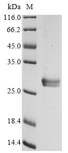 Ribonuclease P protein subunit p25 (RPP25), human, recombinant