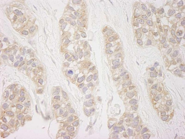 Anti-DDX19 (IHC)
