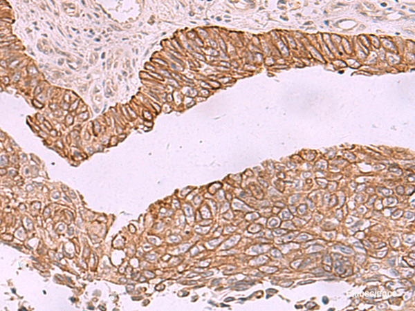 Anti-KCNK12