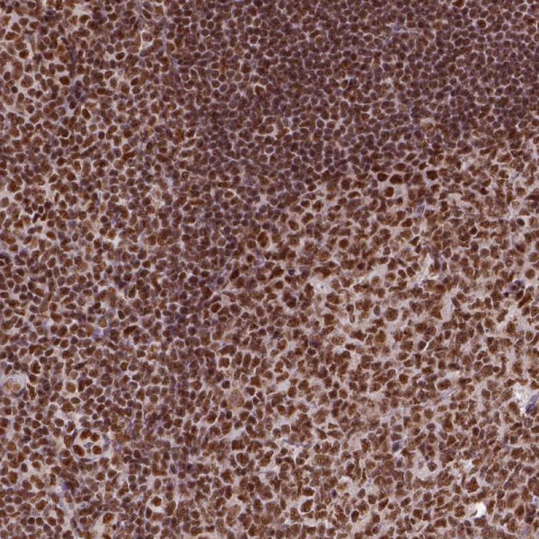 Anti-CCAR1