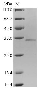 Protein mono-ADP-ribosyltransferase PARP9 (PARP9), partial, human, recombinant