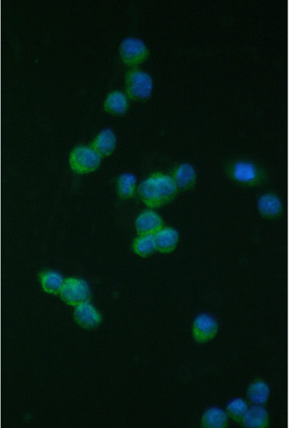 Anti-CD18 / LFA1 beta