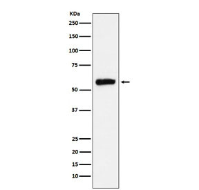 Anti-ALDH2, clone AFOI-1