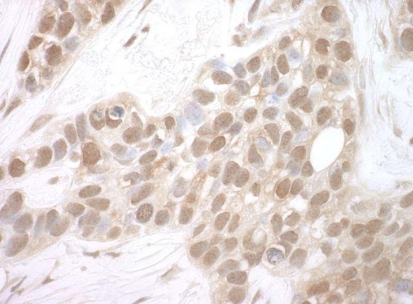 Anti-MERIT40 (IHC)