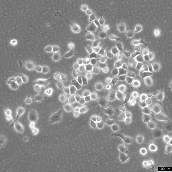 Alab Cells