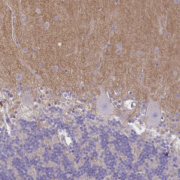 Anti-TTYH1