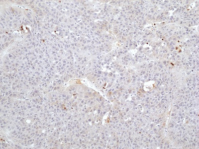 Anti-FGL1 (human), Rabbit Monoclonal (RM502)
