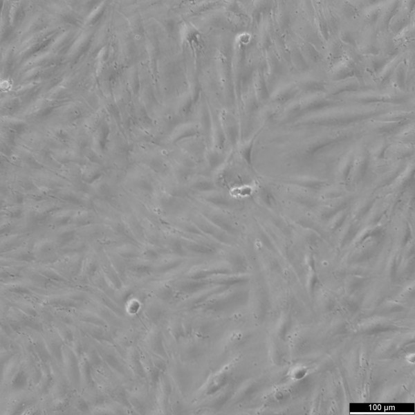KGN Cells