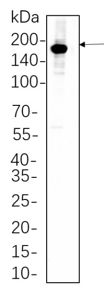 Anti-Recombinant HER2, clone 6H3