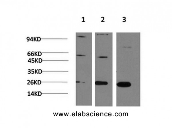 Anti-CBX3, clone 6A4