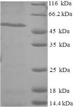 Ras-specific guanine nucleotide-releasing factor RalGPS1 (RALGPS1), human, recombinant