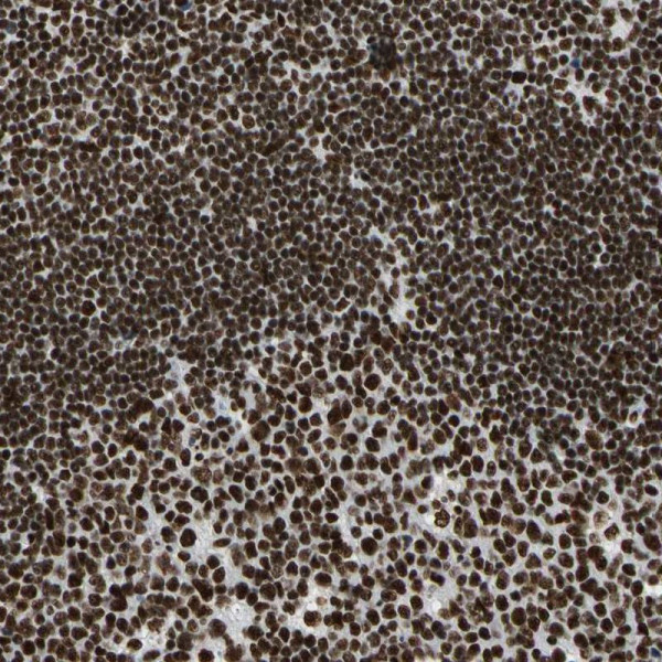 Anti-CCAR1