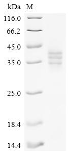 Lymphocyte antigen 6D (Ly6d), recombinant mouse
