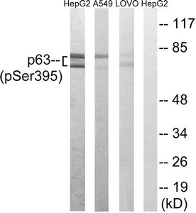 Anti-Phospho-TP63 (Ser395)