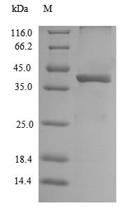 Legumain (Lgmn), mouse, recombinant