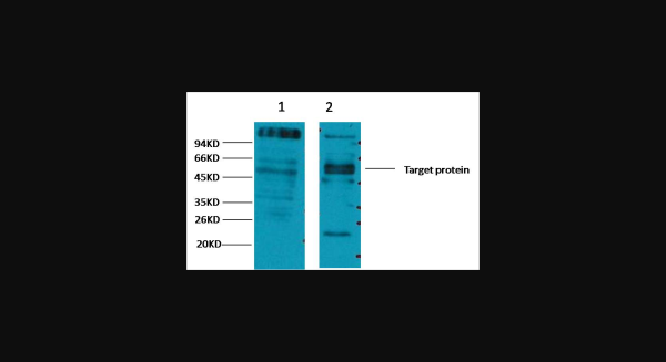 Anti-CD23, monoclonal