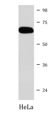 Anti-DDX5 / p68 RNA helicase
