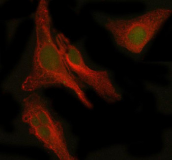 Anti-PEPD / Peptidase D