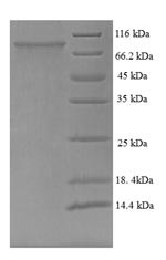 Trichoplein keratin filament-binding protein (TCHP), human, recombinant