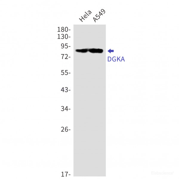 Anti-Recombinant DGKA, clone R06-6H4