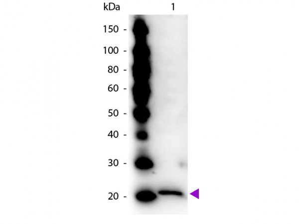 Anti-FERRITIN (Human Spleen)