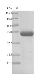 Major pollen allergen Bet v 1-A (BETVIA), Betula pendula, recombinant