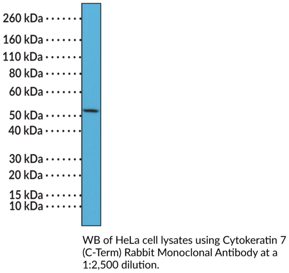 Anti-Cytokeratin 7 (C-Term) Rabbit Monoclonal Antibody (Clone RM284)