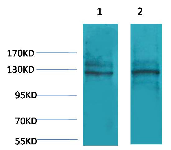 Anti-Calcium Sensing Receptor