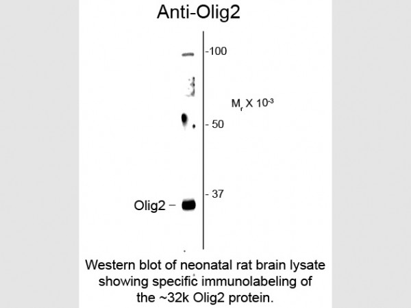 Anti-Olig2