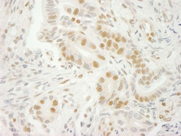 Anti-U2AF35 (IHC)