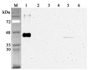 Anti-Sirtuin 2 (human), clone S2R233-1