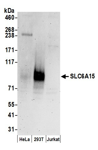 Anti-SLC6A15