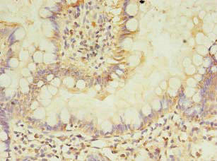 Anti-ASB6