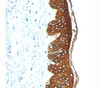 Anti-basic Cytokeratin, clone AE3