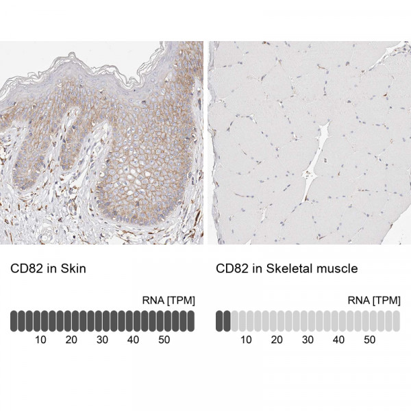 Anti-CD82