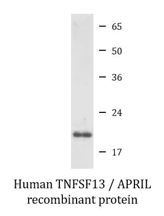 Human TNFSF13 / APRIL recombinant protein (Active)
