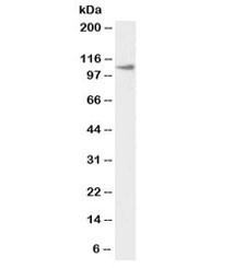 Anti-Thyroid Peroxidase Biotin Conjugate