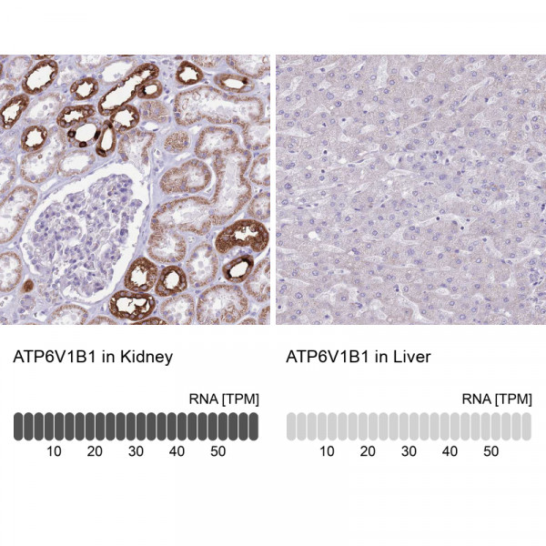 Anti-ATP6V1B1