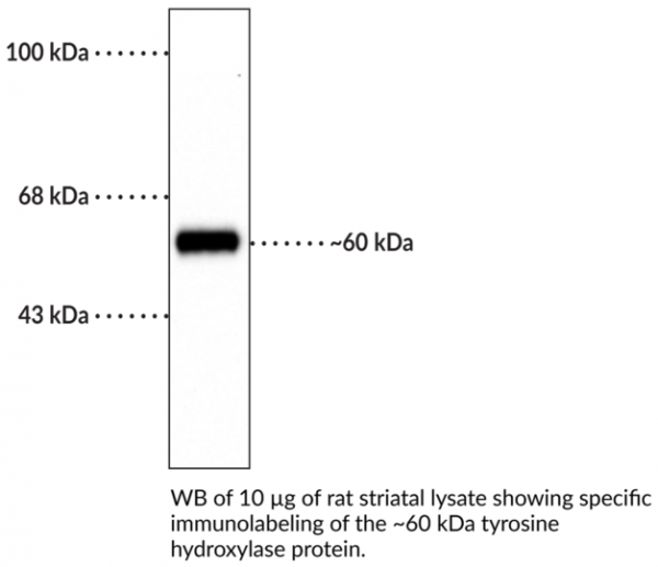 Anti-Tyrosine Hydroxylase