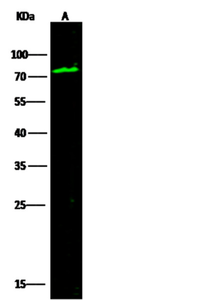 Anti-SerpinG1/C1 inhibitor/C1IN Monoclonal Recombinant Antibody