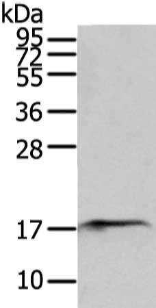 Anti-SNX12