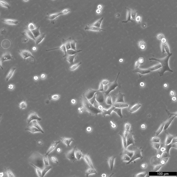 KYSE-30 Cells