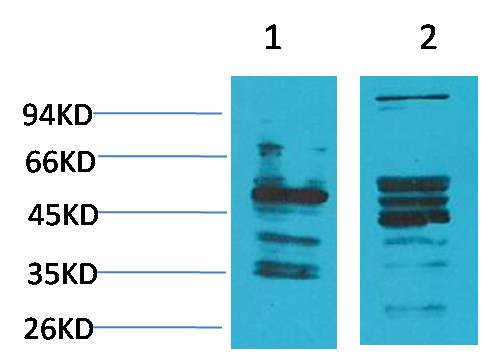 Anti-NMBR (Bombesin Receptor 1)