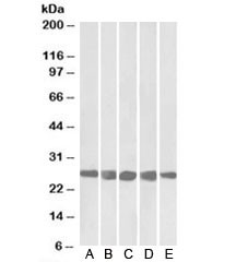 Anti-CSNK2BAntibody