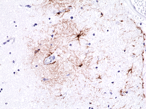 Anti-GFAP, Rabbit Monoclonal (RM246)
